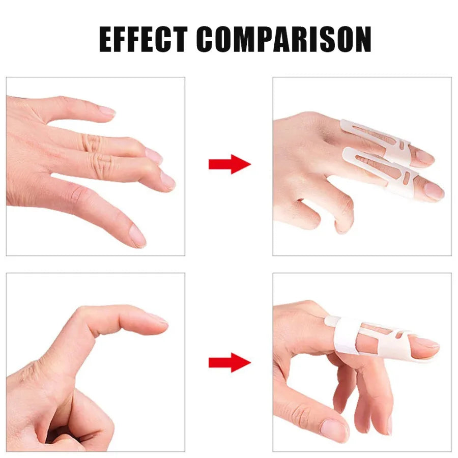 1x Finger Splints Mallet Brace Plastic Finger Support Immobilizer Joint Protection Holder Injury Mallet Sports Finger Protector - Sun Studio