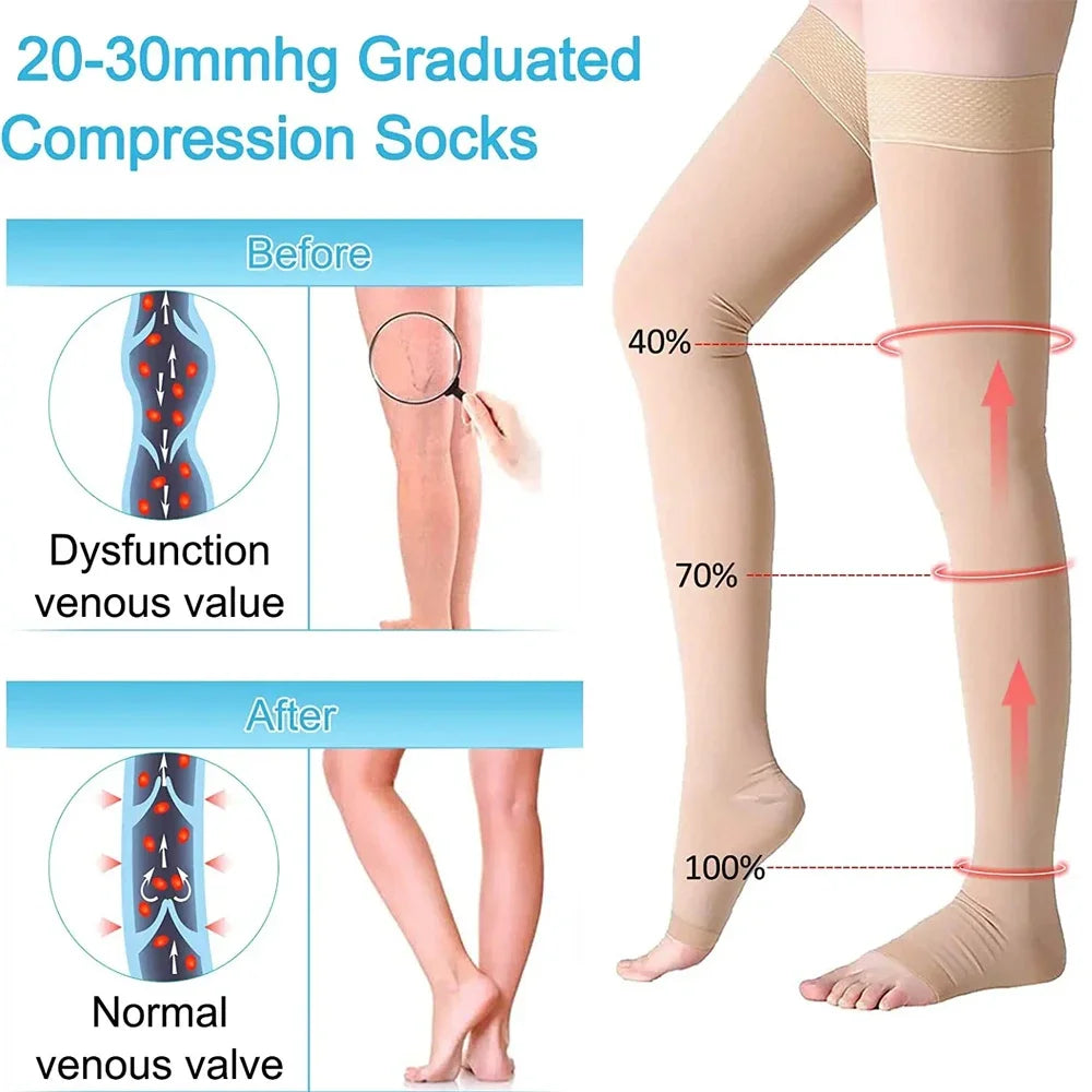 Medical Open Toe Thigh High Compression Stockings with Silicone for Women Men,20-30 mmHg Graduated Support for Varicose Veins - Sun Studio